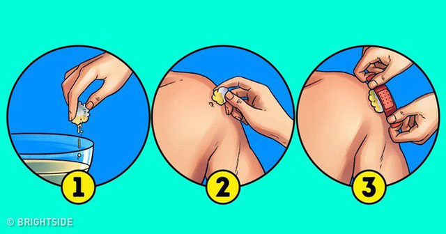 8 phương pháp cực đơn giản mà lại hiệu quả giúp chị em loại bỏ mụn thịt trên da