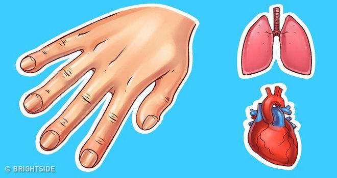 Những căn bệnh nguy hiểm được phát hiện sớm qua dấu hiệu ở bàn tay
