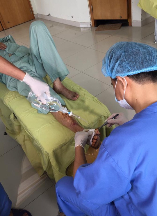 Bác sĩ rùng mình cứu bàn chân hoại tử do bệnh nhân tự chữa đái tháo đường