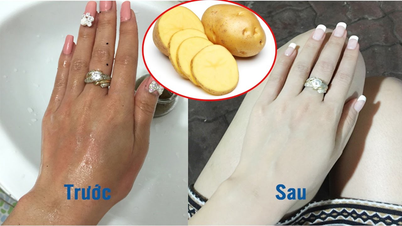 Kết quả hình ảnh cho tắm trắng bằng khoai tây