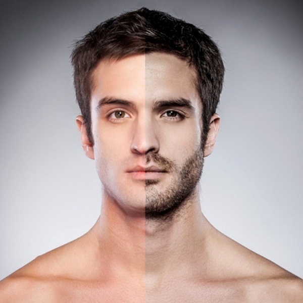 'Tiền mất tật mang' vì trào lưu cấy râu thể hiện sự nam tính