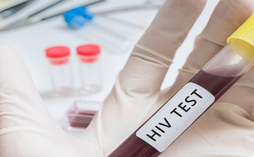 Người nhiễm HIV có thể sống trên... 79 tuổi
