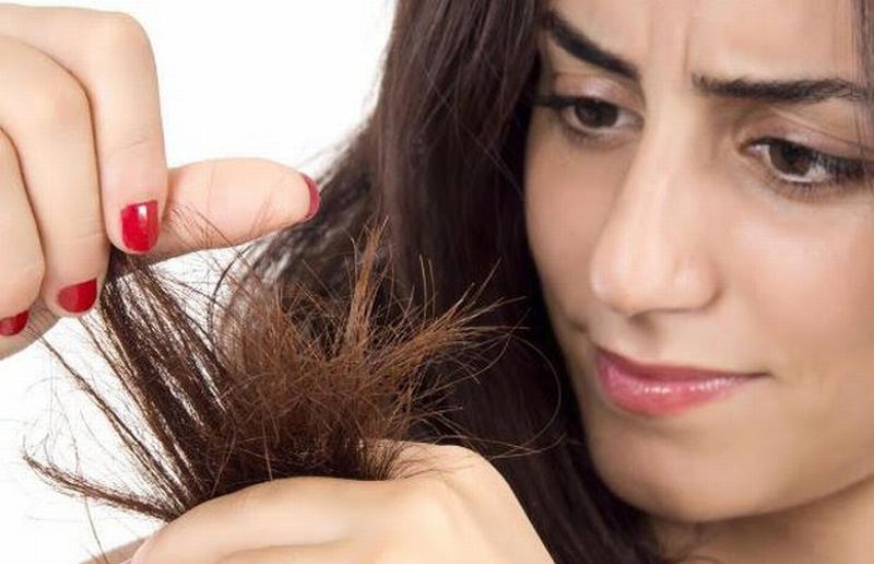 8 dấu hiệu cảnh báo sức khỏe đang có vấn đề thông qua mái tóc 
