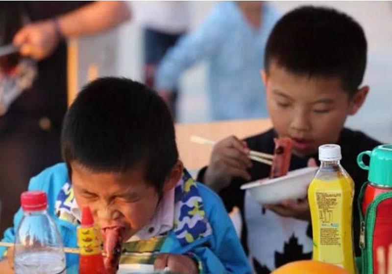 Cậu bé 10 tuổi tử vong vì ung thư ruột, cảnh báo những món ăn hại sức khỏe cho trẻ