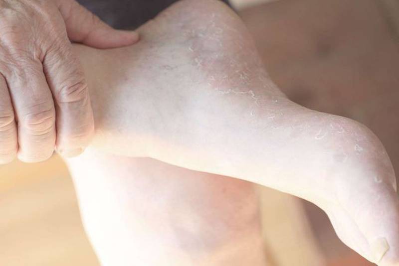 Bàn chân tiết lộ 10 dấu hiệu kín đáo của bệnh - Ảnh 1.