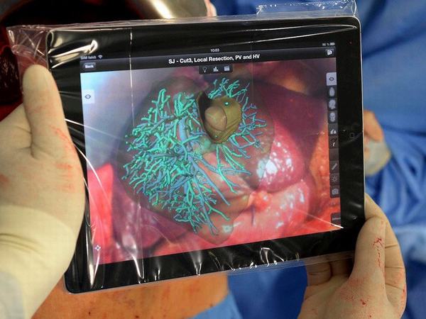 Bác sĩ cách bệnh nhân 3.700km, vẫn có thể phẫu thuật chính xác nhờ công nghệ thực tế ảo