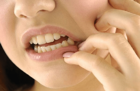 Bài thuốc chữa sâu răng từ lá lốt cực nhanh