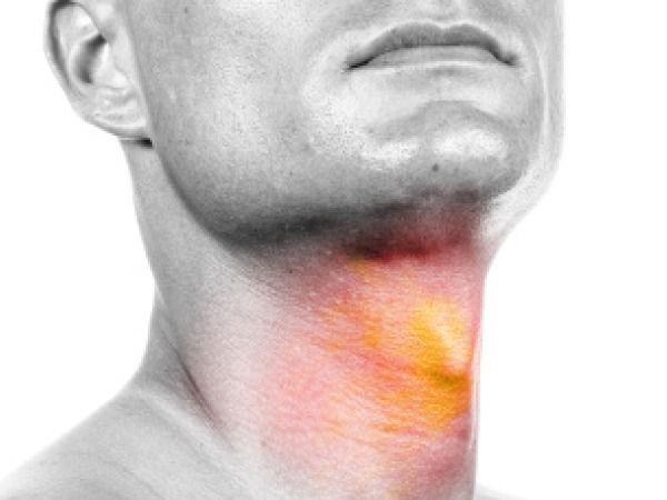 Nhớ các dấu hiệu ung thư vòm họng giai đoạn đầu, cơ hội sống sót lên tới 72%